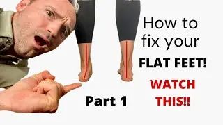 HOW TO FIX YOUR FLAT FEET (Part1)