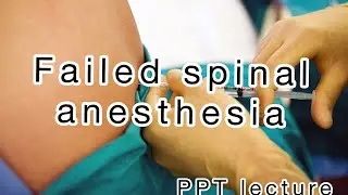 Failed spinal anesthesia | ppt lecture #anesthesia