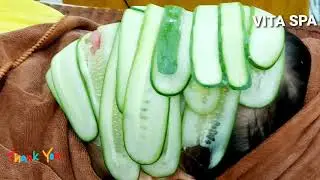 Ph&acirc;n Giải Sắc Tố N&aacute;m - Liệu Tr&igrave;nh Trị N&aacute;m 01- #VitaSpa