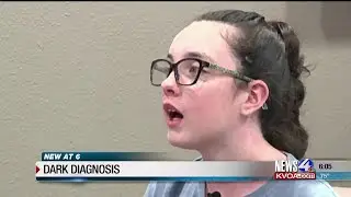'Faces of Narcolepsy' helps shine light on dark diagnosis