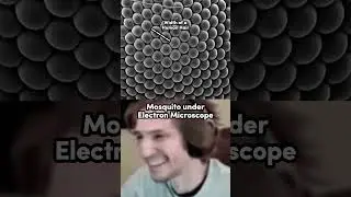 Mosquito Under Electron Microscope #shorts #ytshorts #technology