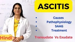 Ascitis : Pathophysiology, Causes, Clinical features, Treatment | Transudate Vs Exudate | Hindi
