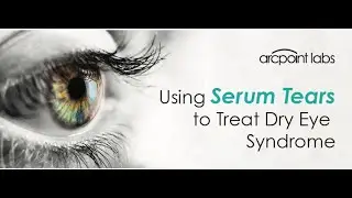 July 2023 Serum Tears Webinar