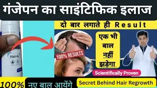 Stop Hair Fall & Regrow Hair Naturally I Minoxidil for Hair Regrowth I  Hair loss रोकने का लोशन