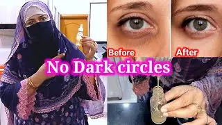 No Dark circles | Effective remedy | BinteSaeed Kitchen and life