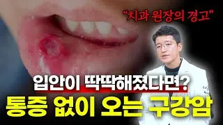 아프지 않아서 병원 안 옵니다｜구강암 신호
