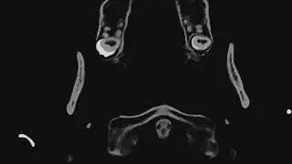 Linn Elisabet - Floss Through Brain (SUBVERTED)