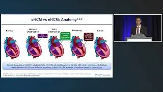 Pushing Back Against HCM: The Role of Cardiac Myosin Inhibitors
