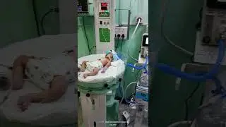 Electrogenics Innovation neonatal respiration device (bubble CPAP)