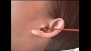 protruding ears woman with ear play 2