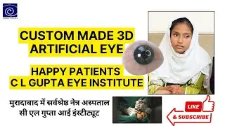 Discover the Best Eye Care at C.L. Gupta Eye Institute #3DArtificialEye #PatientTestimonial