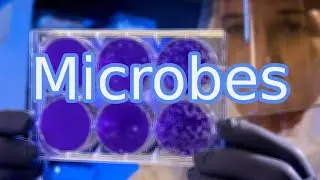 Microbes introduced: the invisible world around us!