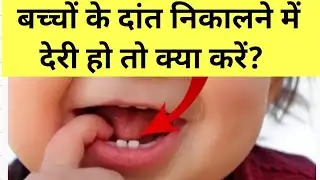 बच्चों के दांत निकालने में देरी हो तो क्या करें ? Delayed tooth eruption #kidsinformation #babyteeth