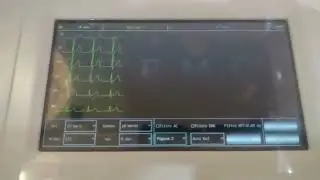 Contec Electrocardiograma ECG600G Demostracion