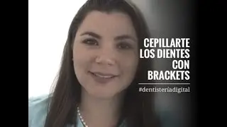 BRACKETS - Como cepillarse los dientes con Brackets