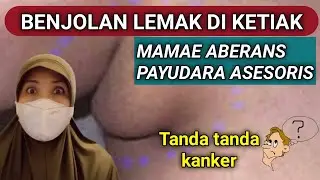 Уплотнения в подмышках, как на груди - MAMAE ABERANS - Аксессуары для груди