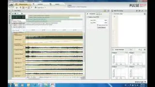 PULSE Reflex Core &ndash; Time recording, analysis and report &ndash; Br&uuml;el & Kj&aelig;r