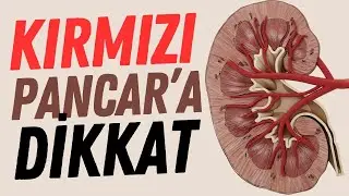 Kırmızı Pancar T&uuml;ketiminde Dikkat Edilmesi Gerekenler #b&ouml;brek #b&ouml;brektaşı