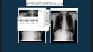 Image J | Place the same ROI position in different images