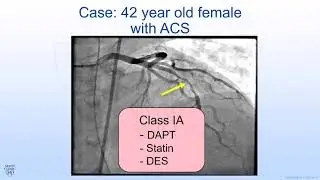 Diagnosis and Management Challenges in Spontaneous Coronary Artery Dissection