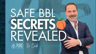 Safe BBL: The Secrets Revealed!