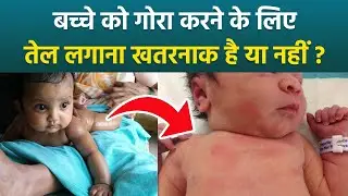 Baby Skin Lightening Massage Oil Side Effects: छोटे बच्चों को गोरा करने के लिए तेल लगाने के नुकसान
