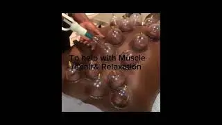 #fitnessjourney#cuppingmassage#cuppingtherapy#fitlifestyle#gymlife#positivevibes