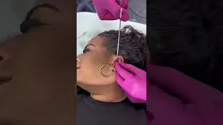 Daith piercing #viral #perte #asmr @baselaboratories