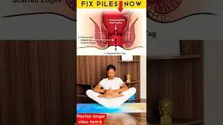 Fix Piles & Fissures Now🔥 #pilesrelief #fissure