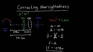 Correcting Nearsightedness using the Far Point