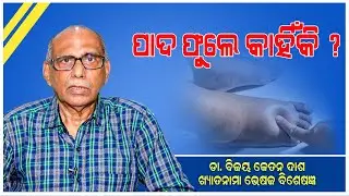 ପାଦ ଫୁଲାର ବହୁବିଧ  କାରଣ  ||Causes Of Foot Swelling | Health Tips ||Health ||Awareness ||Dr BK Dash ||