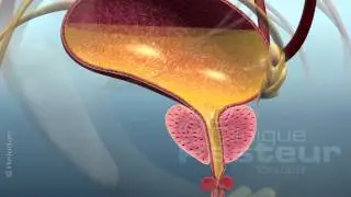 Urologie - Adenome de la prostate - Traitement m&eacute;dical