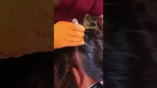 ASMR School Nurse LICE Check on 3 Students but 2 INFESTED #asmr #short #shorts