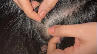 10 Mins Intense Scalp Scratching to Sleep ASMR #asmr #hairbrushing #scalpscratching #nitpickingasmr