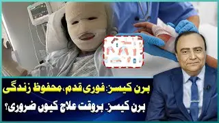 Burn Cases: Quick Steps to Stay Safe | Why Timely Treatment Is Crucial | Sehat Zindagi