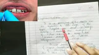 Double lip | Oral pathology | NEET MDS