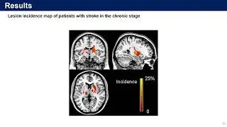 [저널 미팅] Neural Reorganization and Intention Decoding for Motor Recovery after Stroke