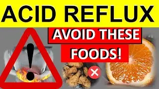 Worst Foods for Acid Reflux| These foods Triggers Acid Reflux symptoms