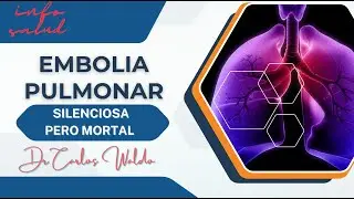 EMBOLIA PULMONAR. Silenciosa pero mortal