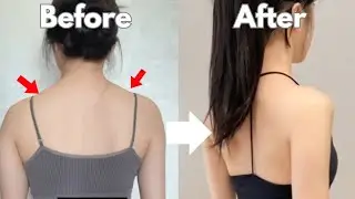 5Minutes Toned Arms, Fix Neck Hump, Slim Back Daily Workout ~ Quick & Effective (Beginners Exercise)