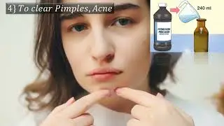 hydrogen peroxide |Kannada health tips |Holistic health