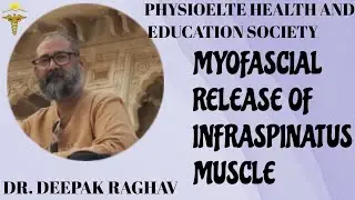 myofascial release of infraspinatus #mfr#physioelitehealthandeducationsociety#frozenshoulder#pain