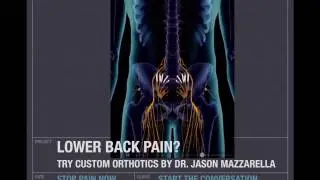 Custom Orthotics Done Right!
