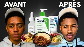 Comment avoir une peau parfaite !!!