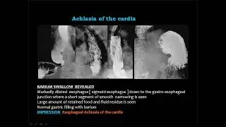 R1  Abdomen  Reporting I   Prof  Mamdouh Mahfouz HD