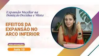 Aula 10 &ndash;Efeitos da Expans&atilde;o no Arco Inferior #TrechoAulas #CursoOnline #Ortodontia