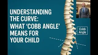 Understanding Cobb Angle
