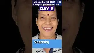 Full Mouth Dental Implants Treatment✨| Best Gift From Husband - Dr Mayur Khairnar