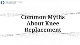 Common Myths About Knee Replacement