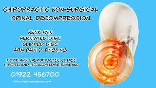 Neck Disc Herniation Chiropractic Treatment Aldridge | Neck Pain Decompression Portland Clinic UK